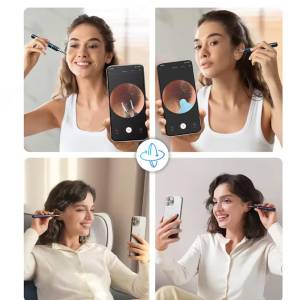 گوش پاک کن هوشمند شیائومی مدل Xiaomi Bebird note 5