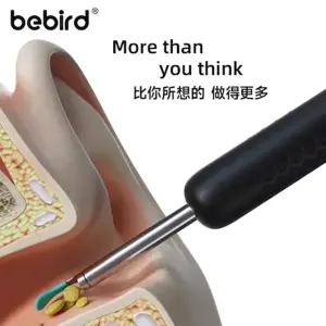 گوش پاک کن تصویری هوشمند شیائومی مدل Bebird R1 Plus