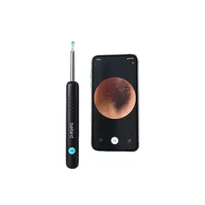 گوش پاک کن تصویری هوشمند شیائومی مدل Bebird R1 Plus